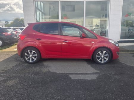 2017 Hyundai ix20 - photo 3
